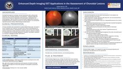 Enhanced Depth Imaging OCT Applications in the Assessment of Choroidal Lesions